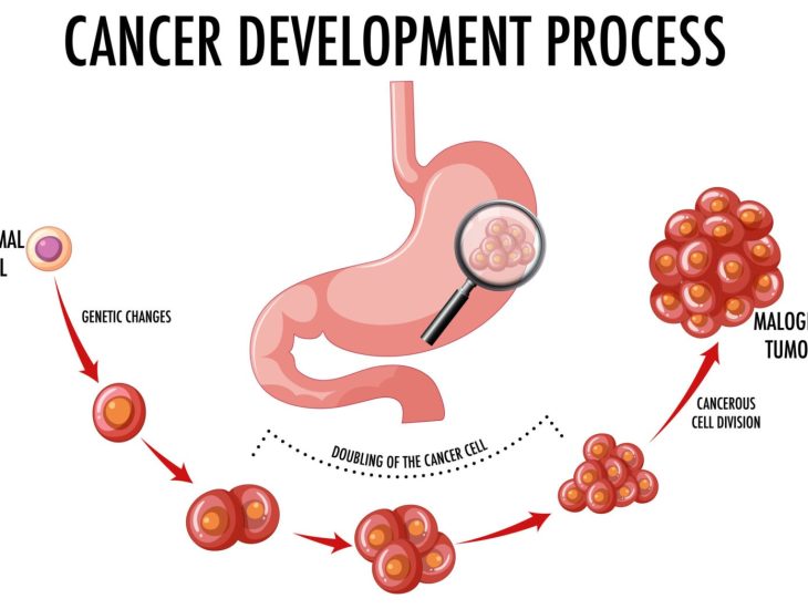 Diagram showing cancer development process