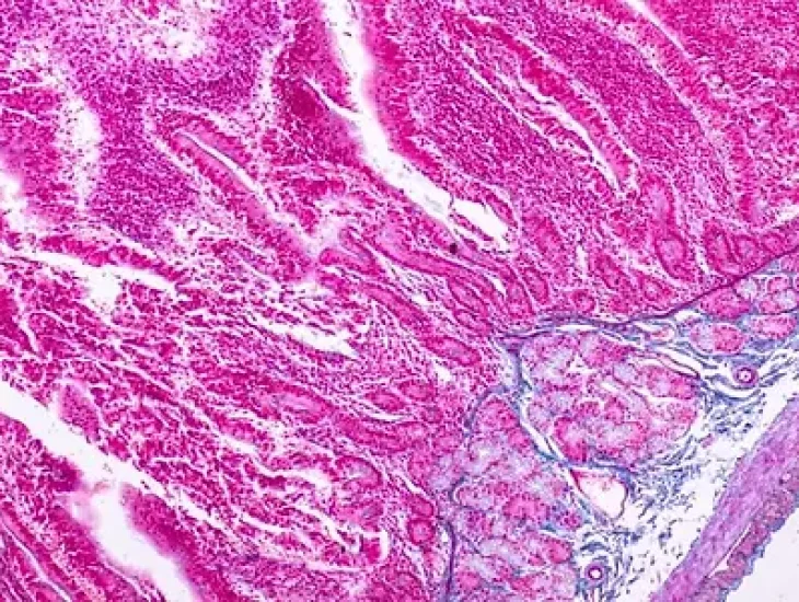 we-just-got-closer-to-a-simple-blood-test-that-can-actually-diagnose-celiac-disease